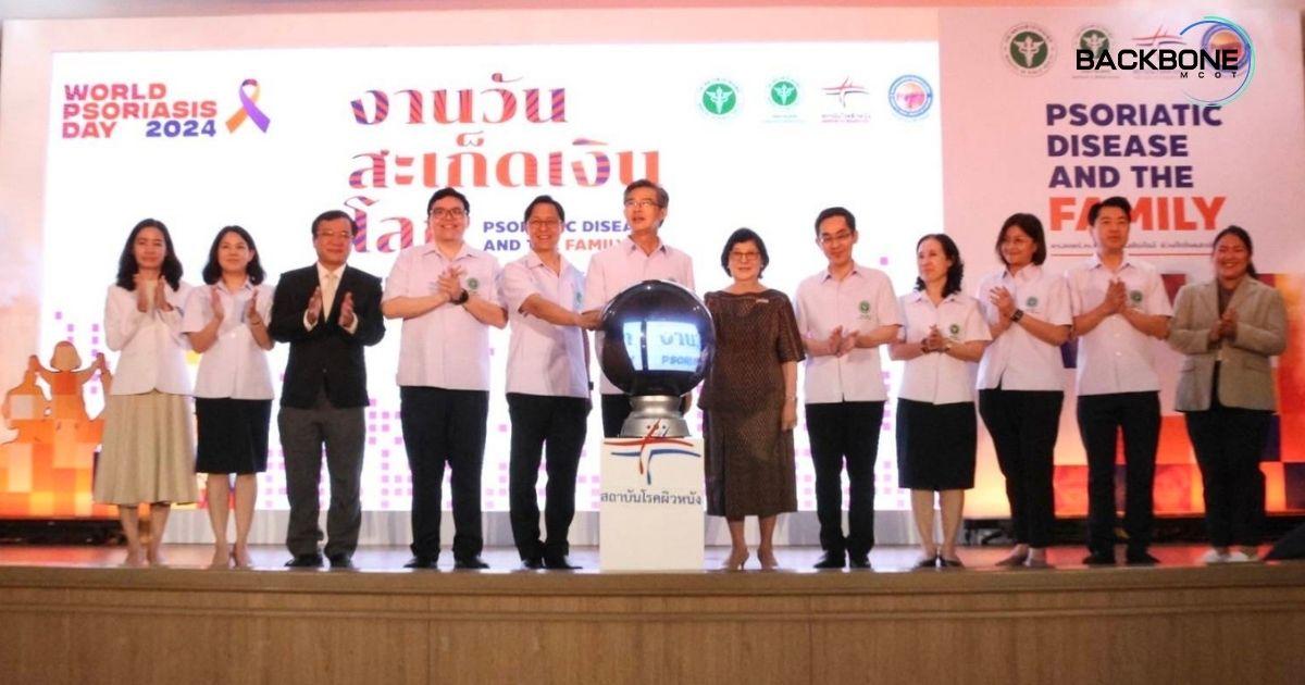 วันสะเก็ดเงินโลก ครอบครัวรวมจิต ดูแลชิดใกล้ ห่วงใยโรคสะเก็ดเงิน