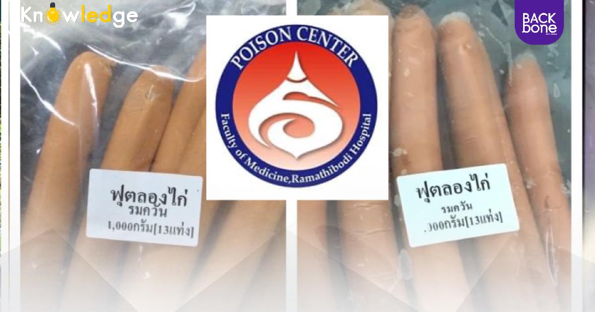 อันตรายมาก! ห้ามกินไส้กรอกไม่มียี่ห้อ ทำเด็กป่วยหนักภาวะขาดออกซิเจน