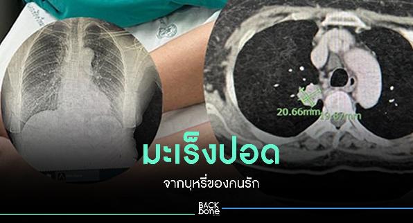 มะเร็งปอด จากบุหรี่ของคนรัก
