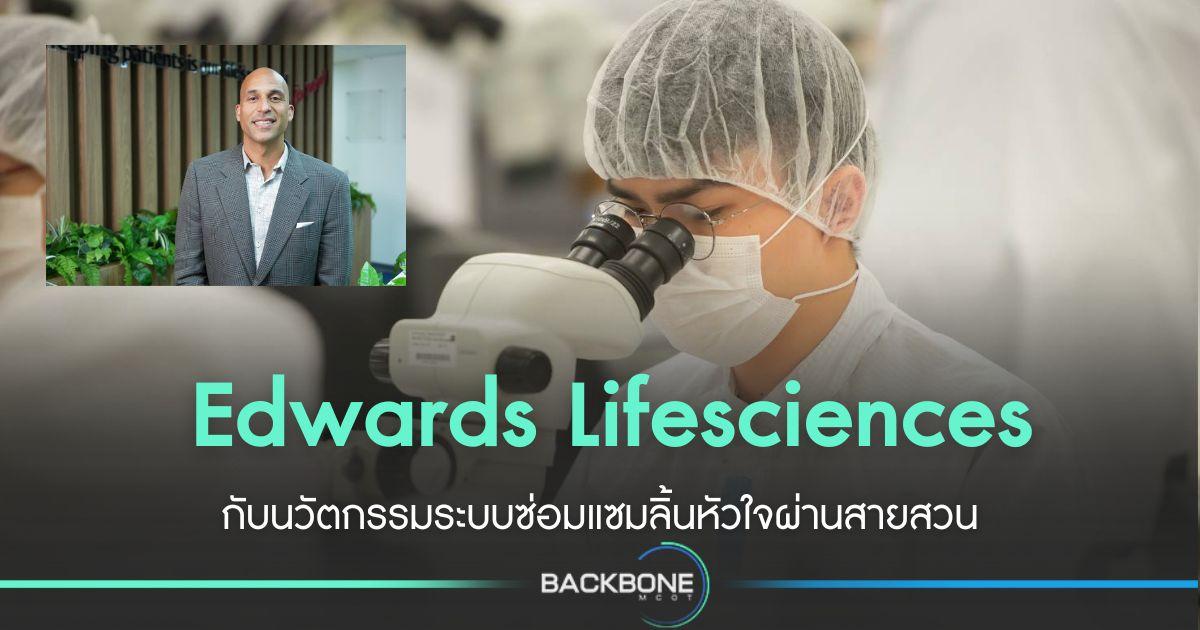 Edwards Lifesciences กับนวัตกรรมระบบซ่อมแซมลิ้นหัวใจ